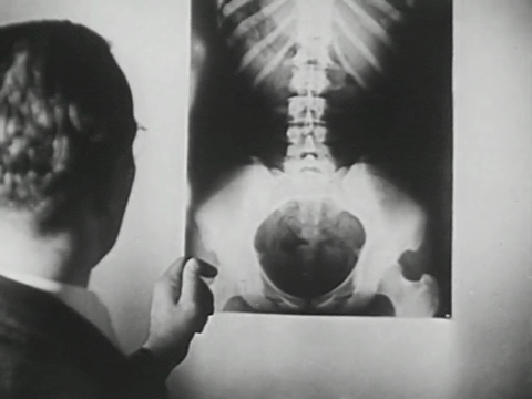 Taking the 'X' out of X-Rays (1940).mp4.6.gif
