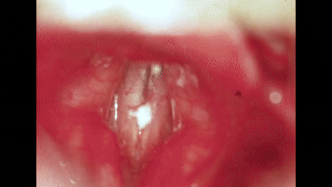The Larynx and voice- Physiology of the Larynx Under Daily Stress (1958).mp4.1.gif