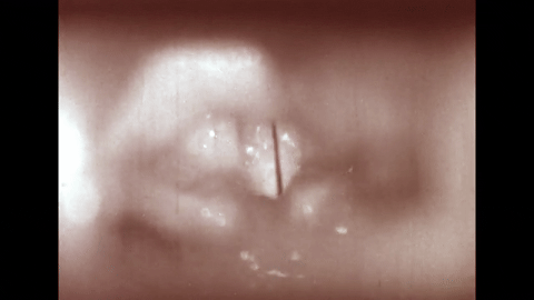 The Larynx and voice- Physiology of the Larynx Under Daily Stress (1958).mp4.6.gif
